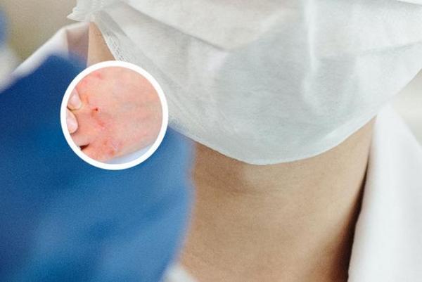 长春有没有专业的银屑病医院-长春市银屑病医院地址