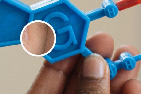 长春治疗银屑病比较好的医院-长春哪个医院治银屑病可以