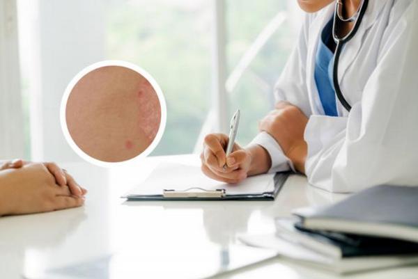 长春治银长春博润皮肤病医院服务好-长春正规的银屑病医院和专家