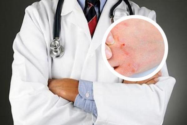 长春哪里有看银屑病的医院-长春哪里看银屑病好