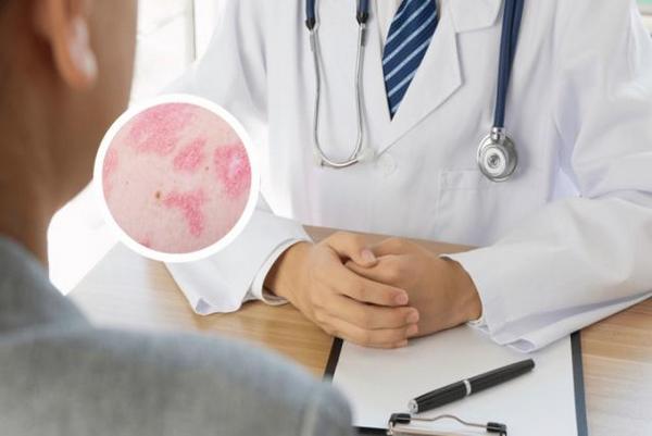 长春博润皮肤病医院贵不贵-长春中医治疗银屑病效果如何