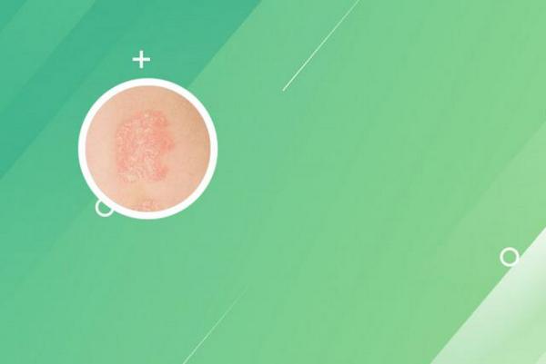 长春博润皮肤病医院官方网址-长春银屑病哪家治疗好