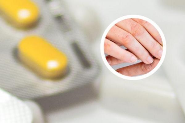 长春哪个医院治银屑病正规-长春治疗银屑病的好方法