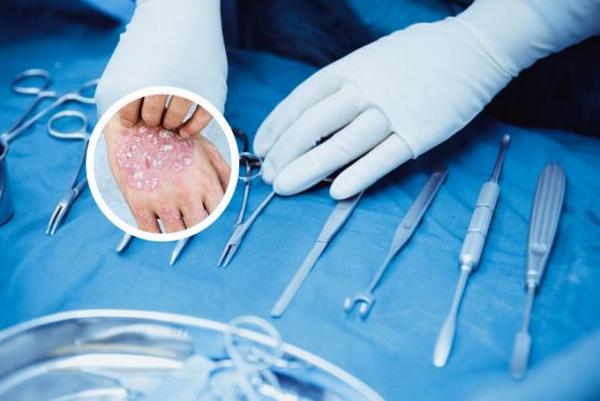 长春专业的看银屑病医院是哪里-长春哪个医院看银屑病效果好