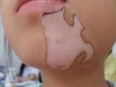 长春有没有治疗白癜风正规的医院-长春治疗白癜风效果好的医院