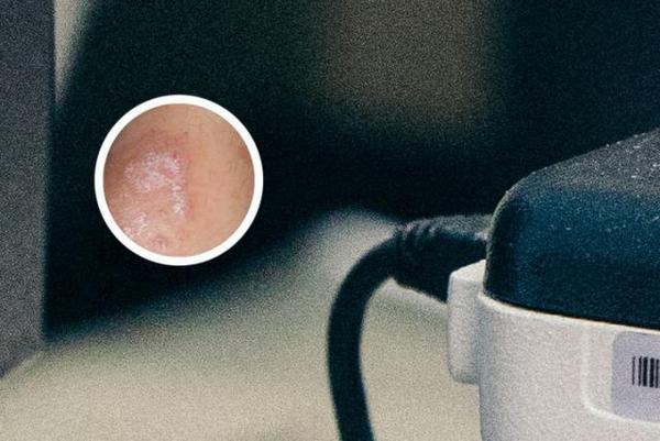 长春银屑病专业医院哪家好-银屑病专业医院长春