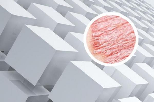 治疗银屑病长春哪家好-长春治疗银屑病到哪家好