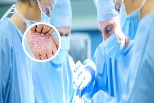 长春专业银屑病医院哪家技术好-长春哪家医院治疗银屑病好